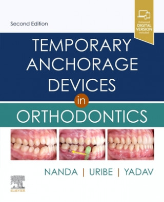 Książka Temporary Anchorage Devices in Orthodontics 