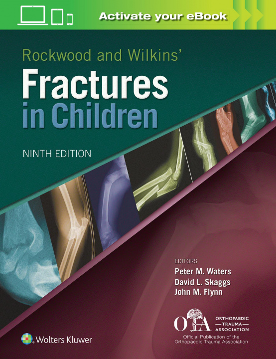 Книга Rockwood and Wilkins Fractures in Children Peter M. Waters