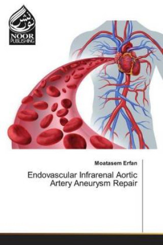 Kniha Endovascular Infrarenal Aortic Artery Aneurysm Repair Moatasem Erfan