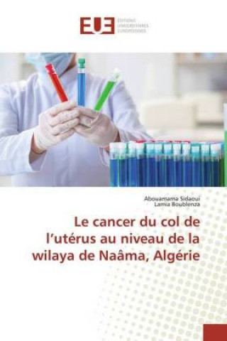 Kniha Le cancer du col de l?utérus au niveau de la wilaya de Naâma, Algérie Abouamama Sidaoui