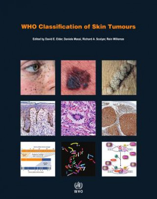Kniha WHO classification of skin tumours collegium