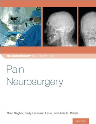 Kniha Pain Neurosurgery Oren Sagher