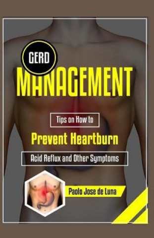 Knjiga GERD Management: Tips On How To Prevent Heartburn, Acid Reflux And Other Symptoms Paolo Jose De Luna