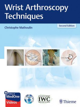 Carte Wrist Arthroscopy Techniques Christophe Mathoulin