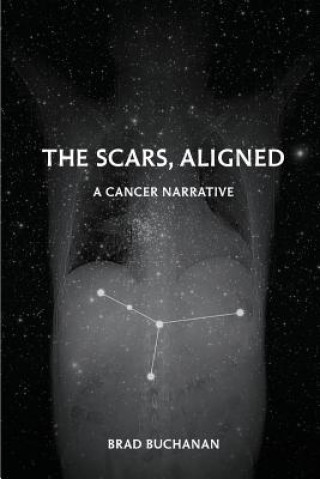 Knjiga The Scars, Aligned Brad Buchanan