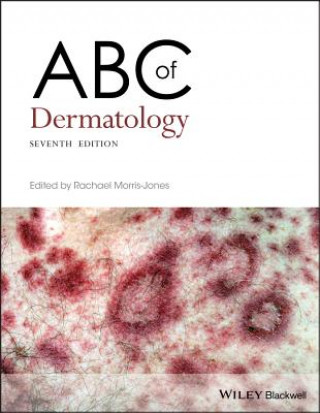 Kniha ABC of Dermatology 7th Edition RACHAE MORRIS-JONES