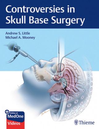 Carte Controversies in Skull Base Surgery Andrew Little