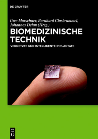 Kniha Biomedizinische Technik - Vernetzte Und Intelligente Implantate Uwe Marschner