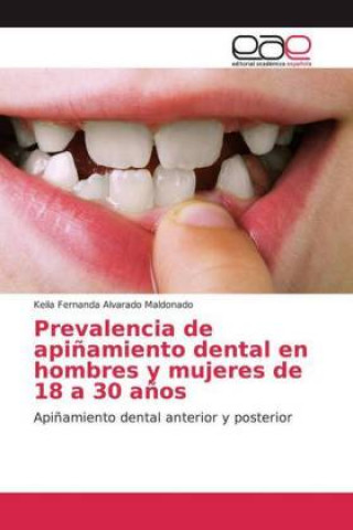 Könyv Prevalencia de api?amiento dental en hombres y mujeres de 18 a 30 a?os Keila Fernanda Alvarado Maldonado