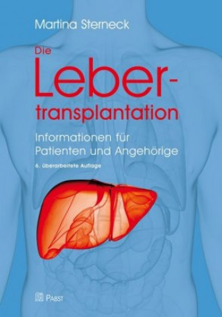 Kniha Die Lebertransplantation Martina Sterneck