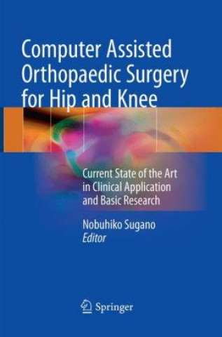 Carte Computer Assisted Orthopaedic Surgery for Hip and Knee Nobuhiko Sugano