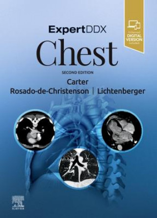 Boek ExpertDDx: Chest Rosado-de-Christenson