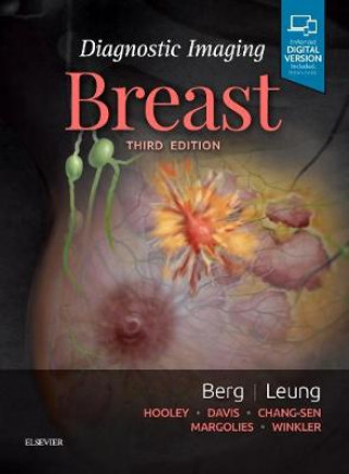 Könyv Diagnostic Imaging: Breast WENDIE A. BERG
