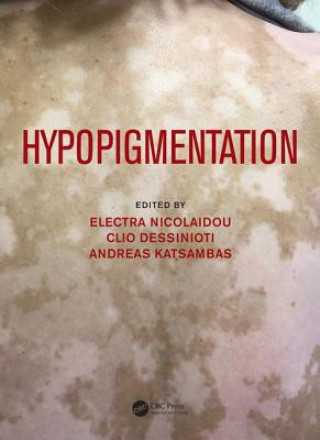 Knjiga Hypopigmentation Andreas Katsambas