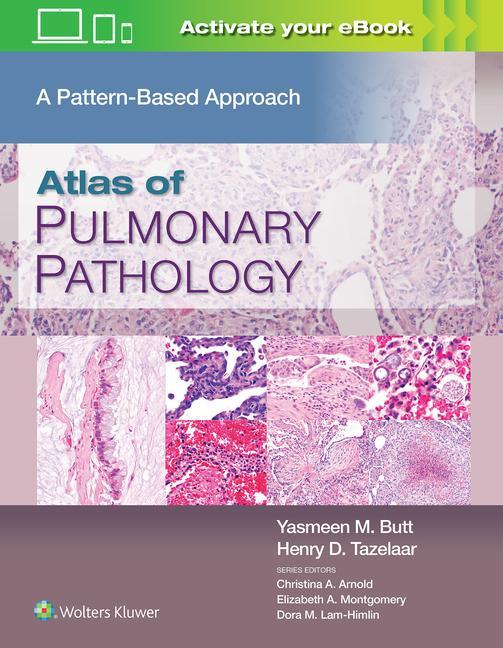 Книга Atlas of Pulmonary Pathology Jennifer Wer