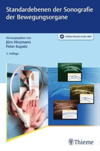 Carte Standardebenen der Sonografie der Bewegungsorgane Jörn Hinzmann
