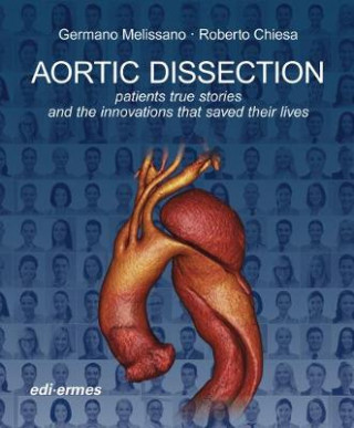 Książka Aortic Dissection: Patients True Stories and the Innovations that Saved their Lives Germano Melissano