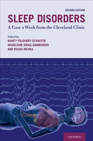 Kniha Sleep Disorders Nancy Foldvary-Schaefer