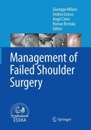 Könyv Management of Failed Shoulder Surgery Giuseppe Milano