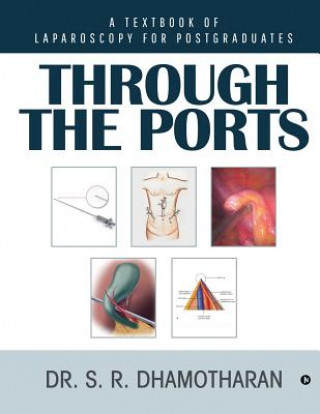 Kniha Through the Ports: A Textbook of Laparoscopy for Postgraduates Dr S R Dhamotharan