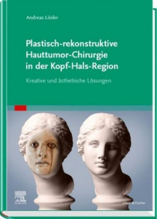 Könyv Plastisch-rekonstruktive Hauttumor-Chirurgie in der Kopf-Hals-Region Andreas Lösler