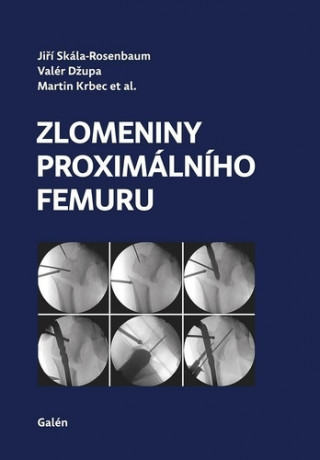 Kniha Zlomeniny proximálního femuru Jiří Skála-Rosenbaum