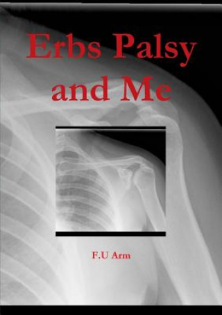 Книга Erbs Palsy and Me F.U Arm