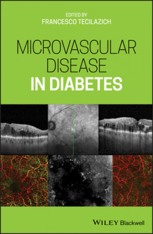 Könyv Microvascular Disease in Diabetes Francesco Tecilazich