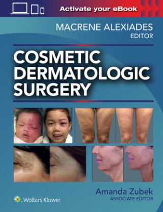 Knjiga Cosmetic Dermatologic Surgery Alexiades