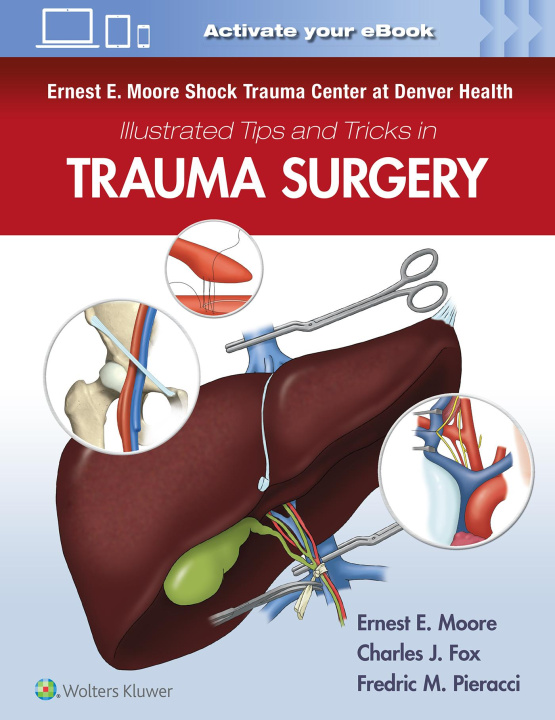Kniha Ernest E. Moore Shock Trauma Center at Denver Health Illustrated Tips and Tricks in Trauma Surgery 