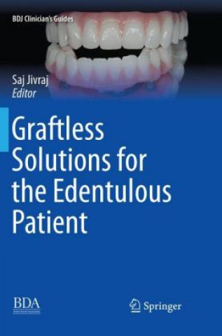 Carte Graftless Solutions for the Edentulous Patient Saj Jivraj