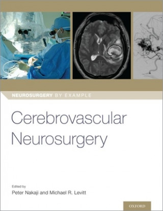 Книга Cerebrovascular Neurosurgery Peter Nakaji