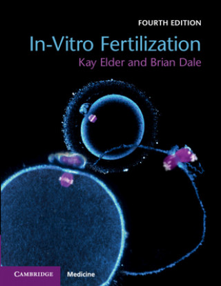 Könyv In-Vitro Fertilization Kay Elder