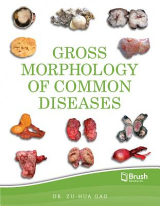 Книга Gross Morphology of Common Diseases Zu-Hua Gao