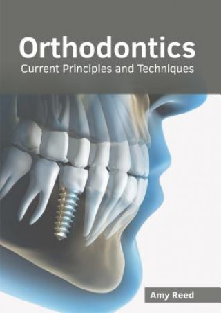 Książka Orthodontics: Current Principles and Techniques Amy Reed