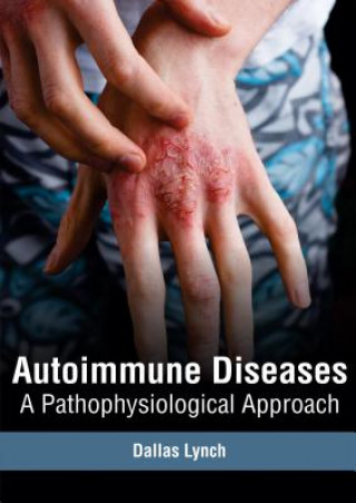 Carte Autoimmune Diseases: A Pathophysiological Approach Dallas Lynch
