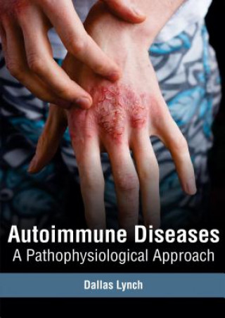 Knjiga Autoimmune Diseases: A Pathophysiological Approach Dallas Lynch