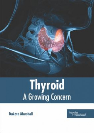 Knjiga Thyroid: A Growing Concern Dakota Marshall