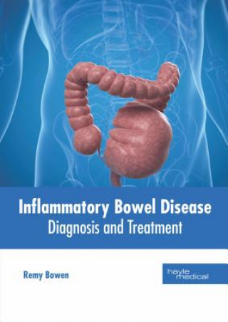 Kniha Inflammatory Bowel Disease: Diagnosis and Treatment Remy Bowen