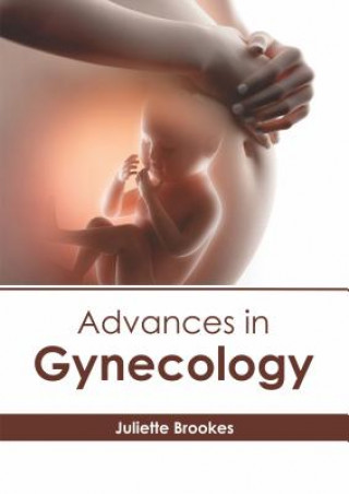 Buch Advances in Gynecology Juliette Brookes