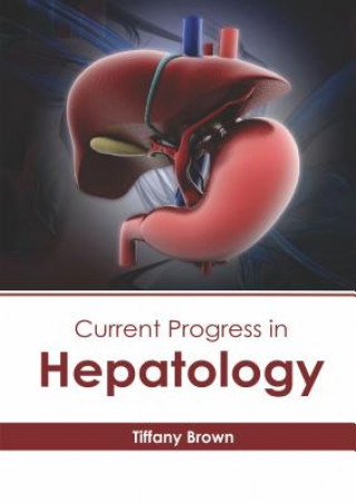 Kniha Current Progress in Hepatology Tiffany Brown