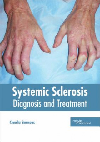 Könyv Systemic Sclerosis: Diagnosis and Treatment Claudia Simmons