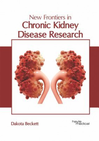 Knjiga New Frontiers in Chronic Kidney Disease Research Dakota Beckett