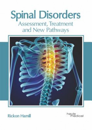 Libro Spinal Disorders: Assessment, Treatment and New Pathways Rickon Hamill
