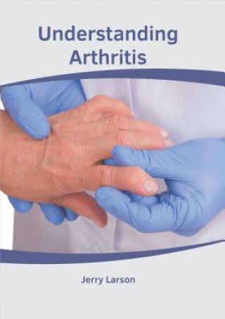 Knjiga Understanding Arthritis Jerry Larson