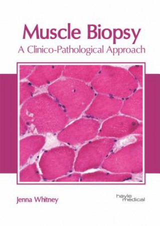 Kniha Muscle Biopsy: A Clinico-Pathological Approach Jenna Whitney