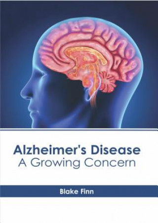 Kniha Alzheimer's Disease: A Growing Concern Blake Finn
