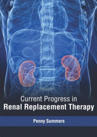 Книга Current Progress in Renal Replacement Therapy Penny Summers