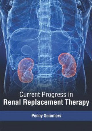 Kniha Current Progress in Renal Replacement Therapy Penny Summers