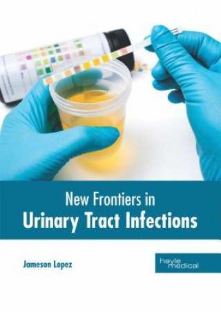 Könyv New Frontiers in Urinary Tract Infections Jameson Lopez